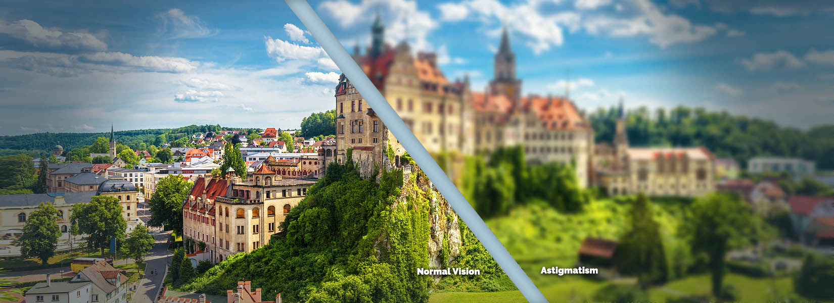 Astigmatism Treatment in North Richland Hills