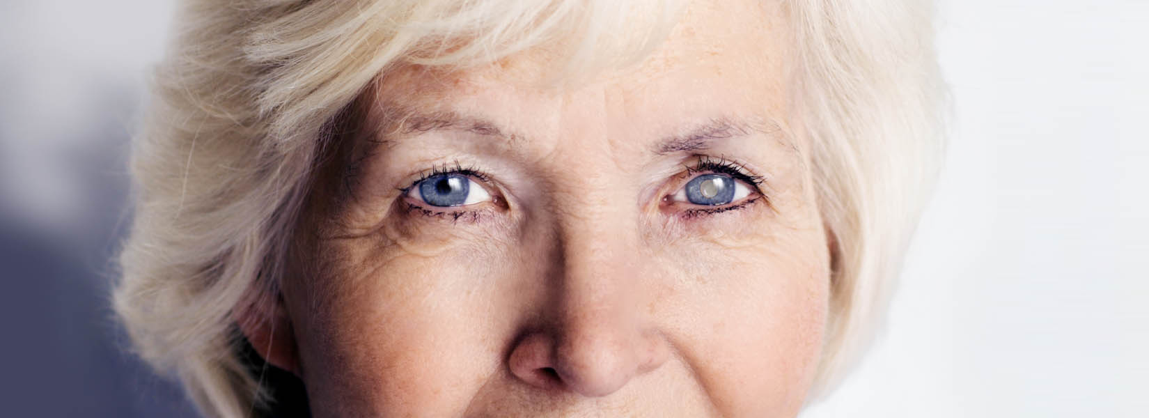 Cataract Surgery in North Richland Hills